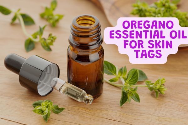 Oregano essential oil for skin tags.