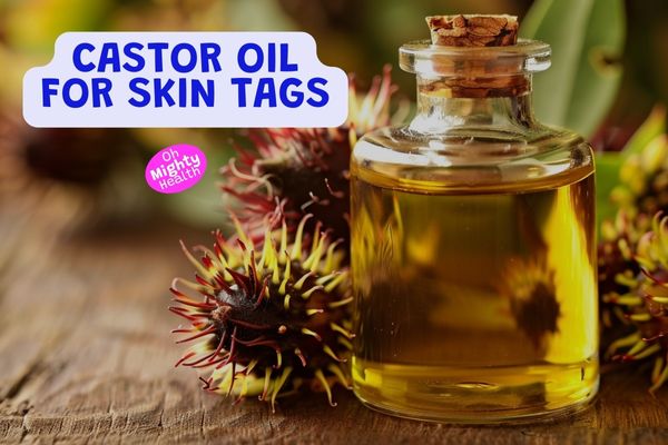 Castor oil for skin tags.