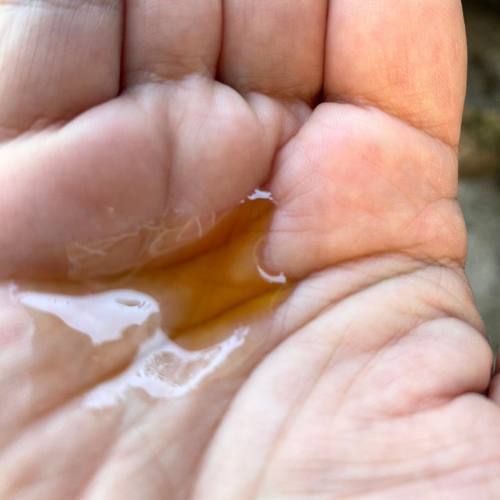 Get BRIGHTER skin with vitamin E for face (it works!)