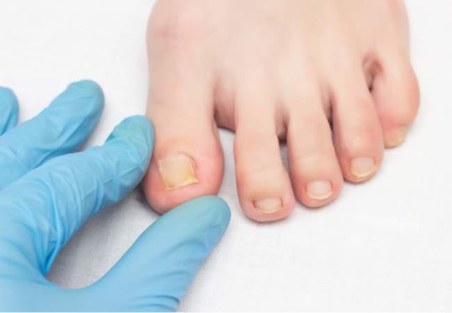 Toenail Health 101: How to Keep Your Nails Strong, Smooth, and Problem-Free Naturally