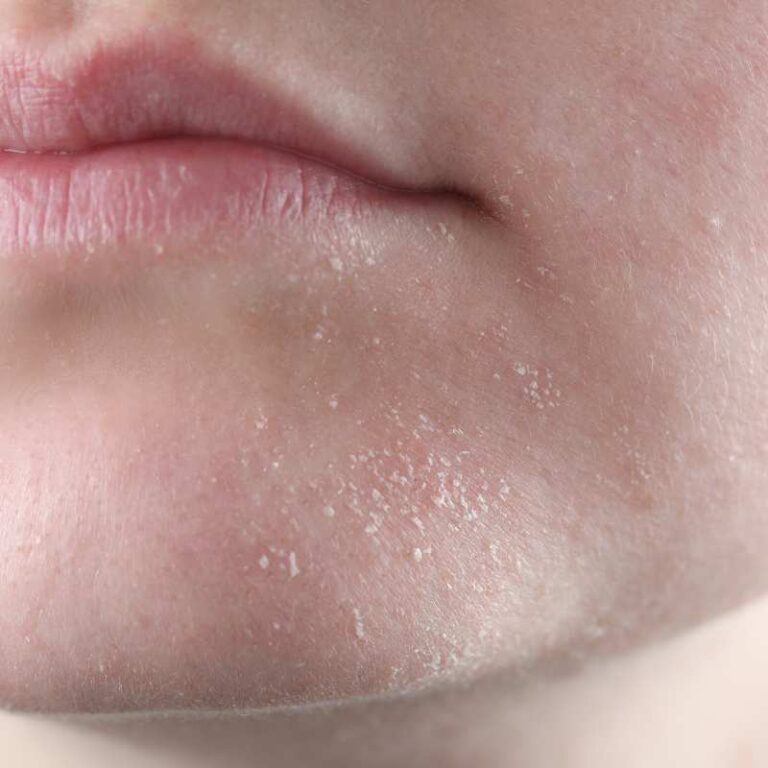 Your Winter Skincare Routine, Simplified (and Natural)