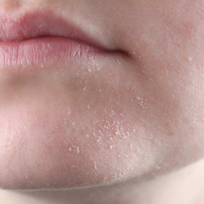 Your Winter Skincare Routine, Simplified (and Natural)